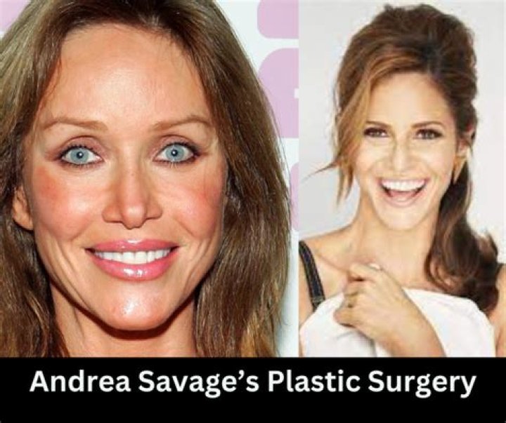 Andrea Savage Plastic Surgery: What Did She Do? Before And After Photo