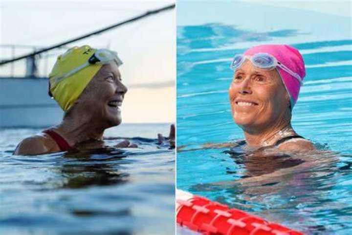 
Australian Swimmer Annette Kellerman Accident Led To Spinal Injury, Here Are The Details 