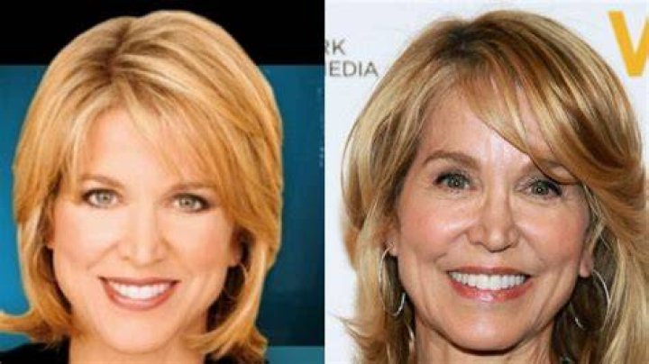
Did Bobbi Althoff Get Plastic Surgery? Who is Bobbi Althoff? 