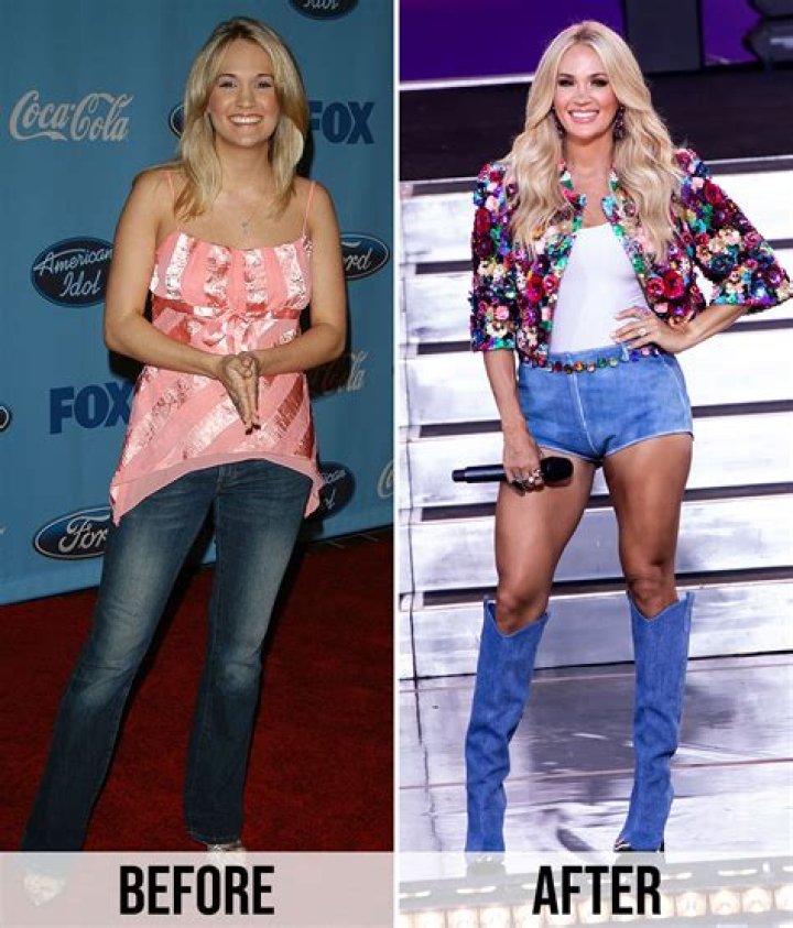 
Did Carrie Underwood Lose Weight Or Is It Plastic Surgery? Here Are Before And After Pictures 