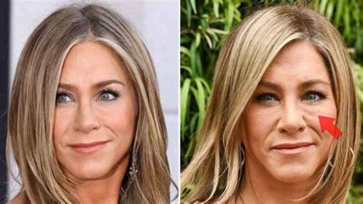 Fans Think Sheryl Crow Has Plastic Surgery Done On Her But Her Friends Say Otherwise