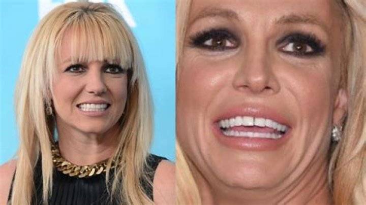 Melanie Gaydos Teeth: What Happened To her? Who Is Her Husband?