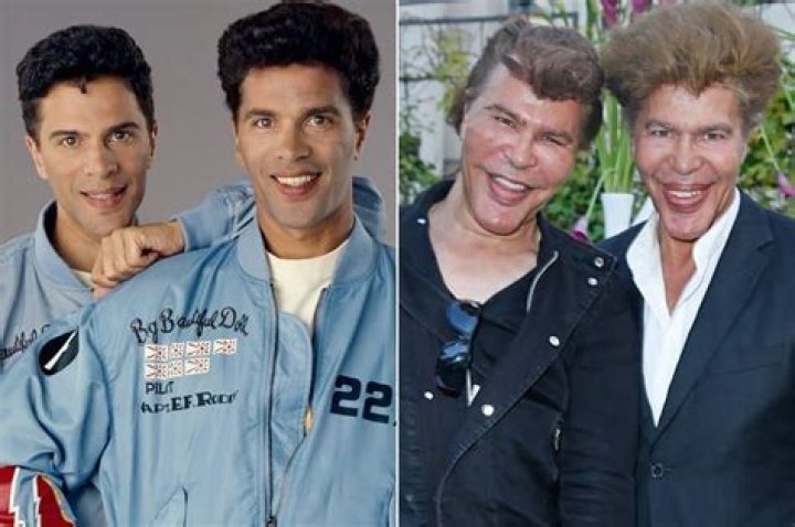 Twin Brothers Igor And Grichka Bogdanoff Before Plastic Surgery