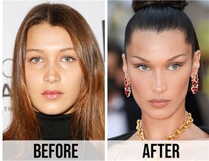 
What Did Bella Hadid Look Like Before Nose Job? Pre Plastic Surgery And Face Tape Photos Revealed! 
