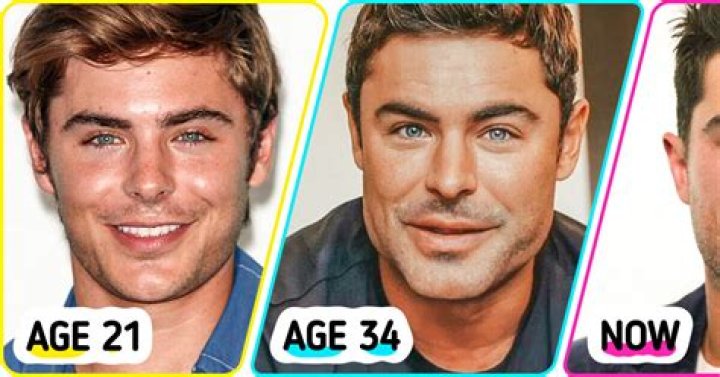 Zac Efron Plastic Surgery Video, Before & After Photos In 2022 – Has He Gotten Cosmetic Surgery?